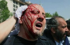 Tear gas, water cannons used on protesters trying to stop Turkish park being turned into shopping mall