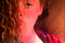 9 people who had their weekend ruined by sunburn