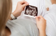 Younger mothers at higher risk of premature birth