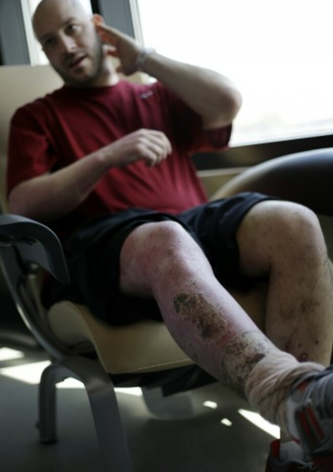Boston Marathon Staggering Survivor
