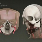 Computer generated image showing the reconstruction of the patient's face.