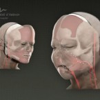 The operation was carried out by a team at the Vall d-Hebron University Hospital, Barcelona.