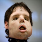'Oscar', the man who underwent a full face transplant in April, appears in public for the first time.