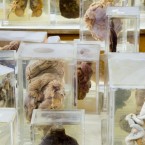Anatomical specimens, Earlsfort Terrace, 2006.