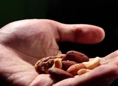 Are you allergic to nuts? Really? 