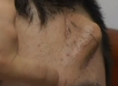 This is how it looks after nine months. 