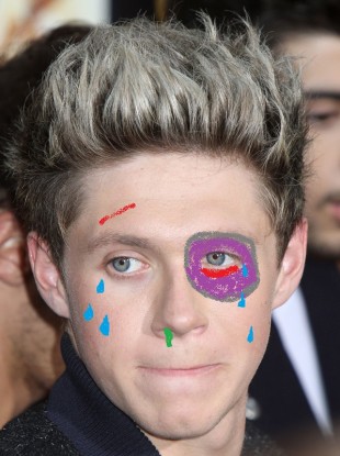 Artist's rendition of what Niall might look like post-fight.
