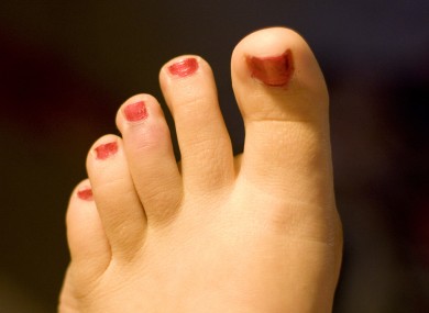 File photo of some toes