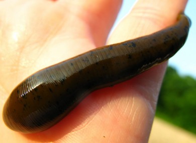 File photo of a freshwater leech